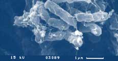 REM-Aufnahme einer Bakterienkolonie